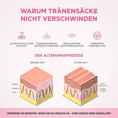 LuminEyes® 2-in-1 Rotlicht-Therapie + EMS Um Tränensäcke Loszuwerden